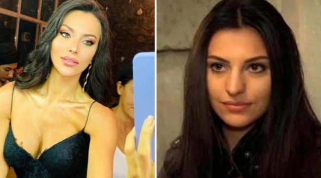 Eski fotoğrafının paylaşılması Tuvana Türkayı kızdırdı: Burnum dışında estetiğimi çıkarın ülkeyi terk ederim