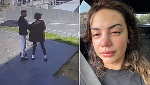 Ece Ronay, boşandığı Bilir'den şiddet gördüğü görüntüleri paylaştı: "Ölümle tehdit ediliyorum"